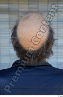 Street  734 bald hair head 0002.jpg